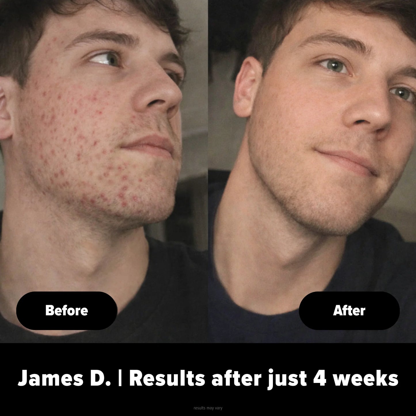 Face Buffer