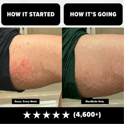 Precision Trimmer