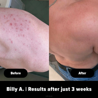 Body Buffer